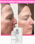 Glamory - Sistema facial de microinfusão